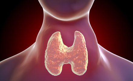 Thyroid Gland Enlargement (Goiter) Causes, Symptoms and Treatment Methods