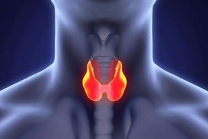 Tiroid Kanseri Nedir?